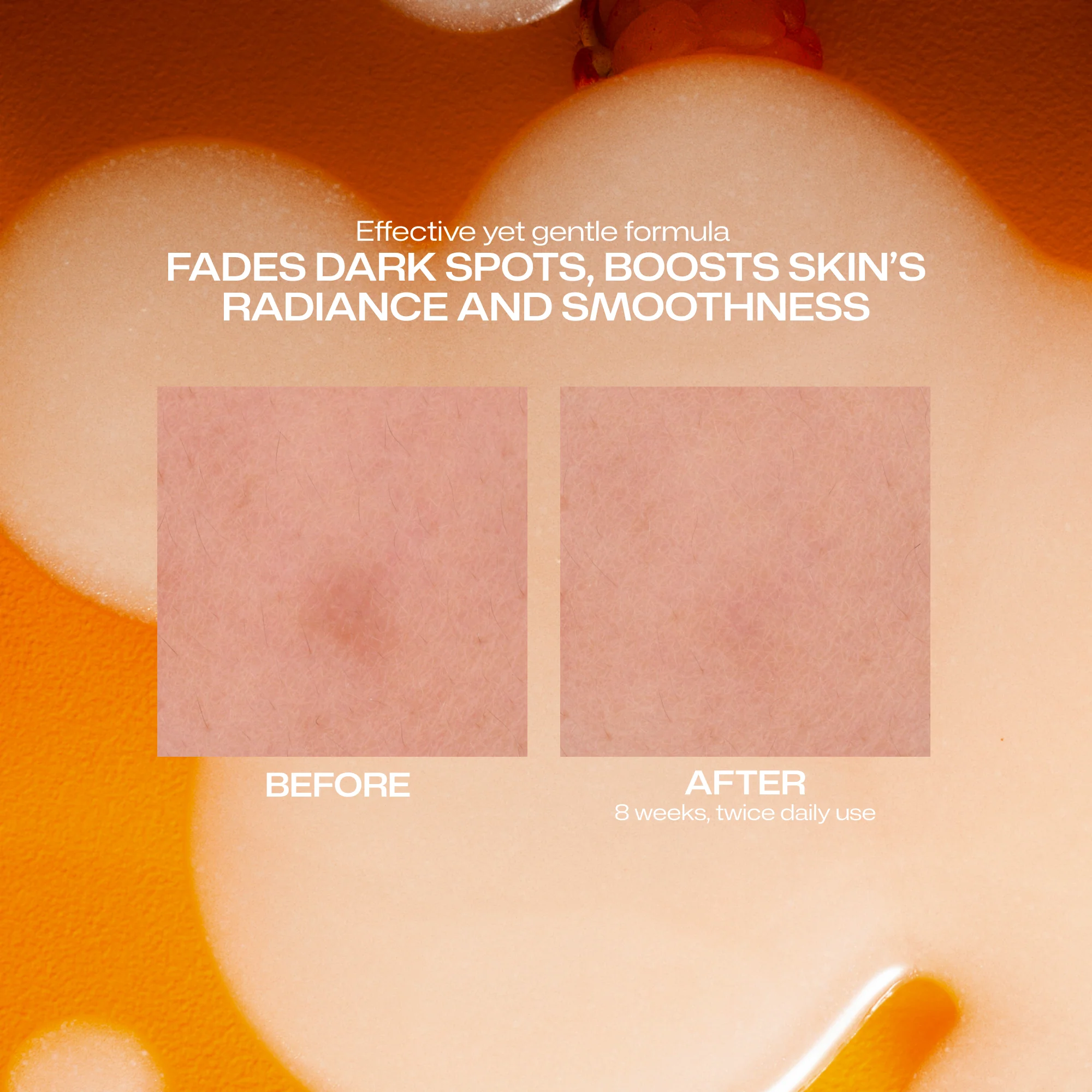 Dark Spot Serum - Image 6